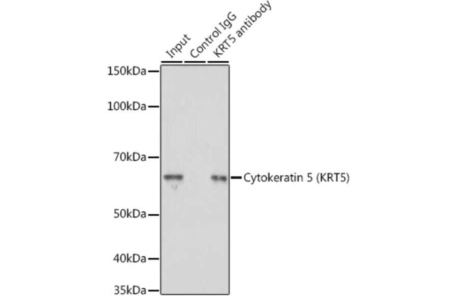 Western Blot - Anti-Cytokeratin 5 Antibody (A14122) - Antibodies.com