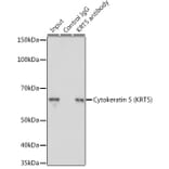 Western Blot - Anti-Cytokeratin 5 Antibody (A14122) - Antibodies.com