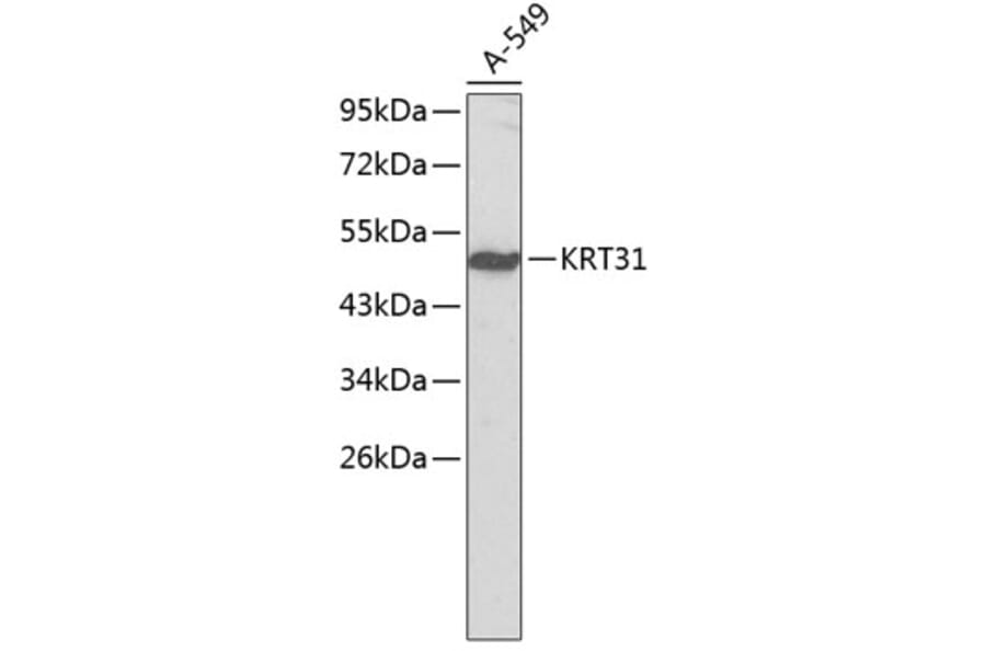 Western Blot - Anti-KRT31 Antibody (A2663) - Antibodies.com