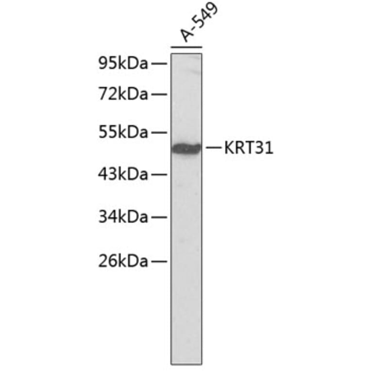 Western Blot - Anti-KRT31 Antibody (A2663) - Antibodies.com