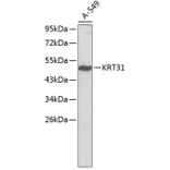 Western Blot - Anti-KRT31 Antibody (A2663) - Antibodies.com