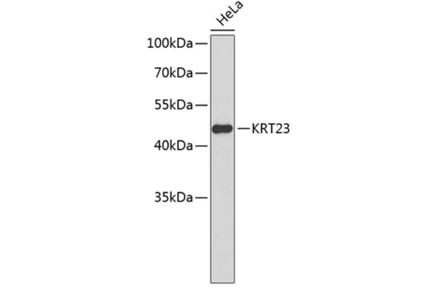 Western Blot - Anti-KRT23 Antibody (A2664) - Antibodies.com