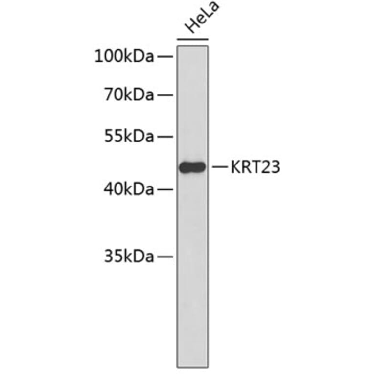 Western Blot - Anti-KRT23 Antibody (A2664) - Antibodies.com