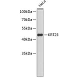 Western Blot - Anti-KRT23 Antibody (A2664) - Antibodies.com
