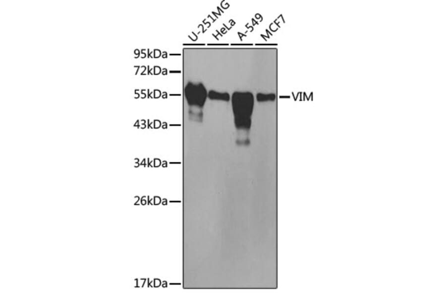 Western Blot - Anti-VIM Antibody (A2666) - Antibodies.com