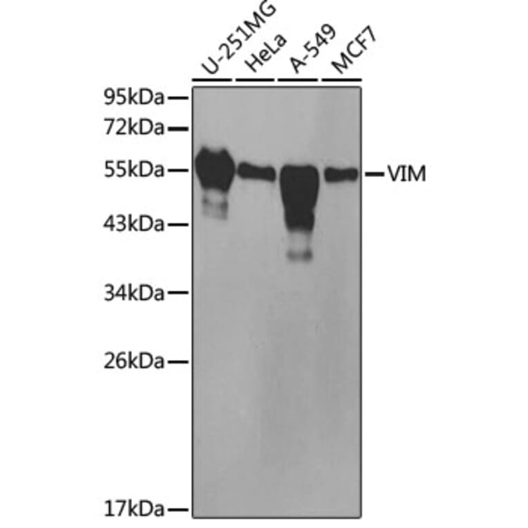 Western Blot - Anti-VIM Antibody (A2666) - Antibodies.com