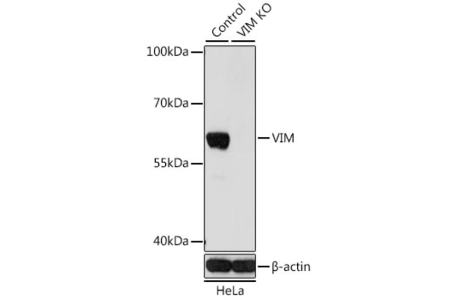 Western Blot - Anti-VIM Antibody (A2666) - Antibodies.com