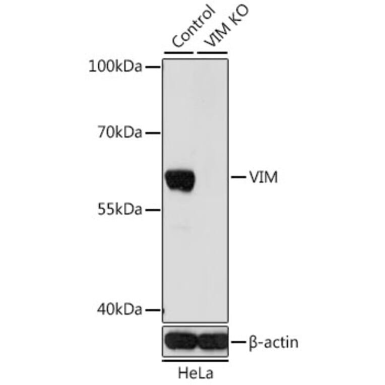 Western Blot - Anti-VIM Antibody (A2666) - Antibodies.com