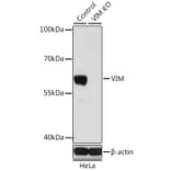 Western Blot - Anti-VIM Antibody (A2666) - Antibodies.com
