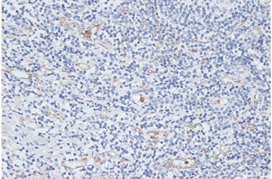 Immunohistochemistry - Anti-VIM Antibody (A2666) - Antibodies.com