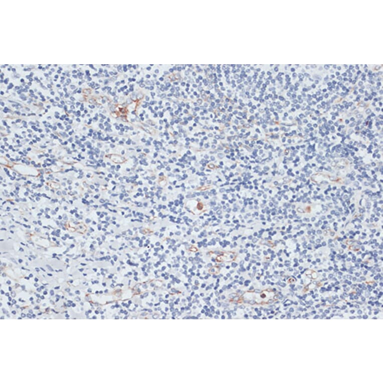 Immunohistochemistry - Anti-VIM Antibody (A2666) - Antibodies.com