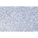 Immunohistochemistry - Anti-VIM Antibody (A2666) - Antibodies.com