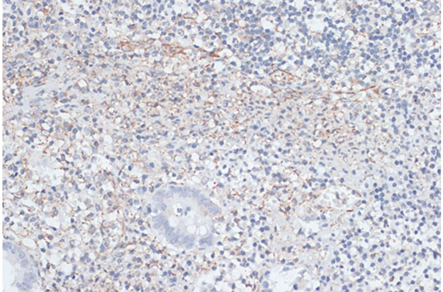 Immunohistochemistry - Anti-VIM Antibody (A2666) - Antibodies.com