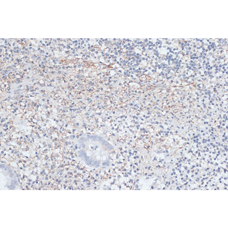 Immunohistochemistry - Anti-VIM Antibody (A2666) - Antibodies.com