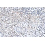 Immunohistochemistry - Anti-VIM Antibody (A2666) - Antibodies.com