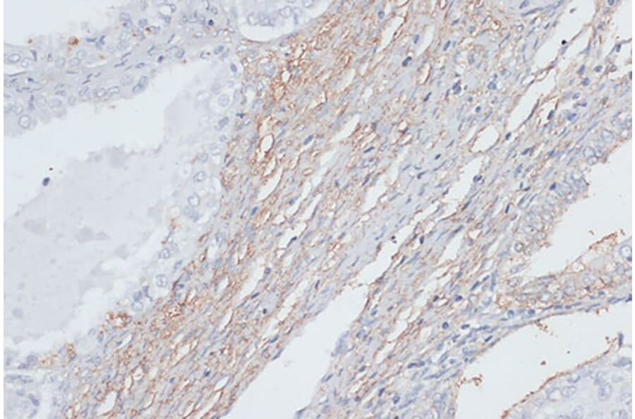 Immunohistochemistry - Anti-VIM Antibody (A2666) - Antibodies.com