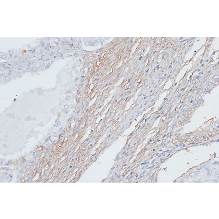 Immunohistochemistry - Anti-VIM Antibody (A2666) - Antibodies.com