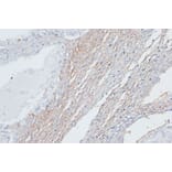 Immunohistochemistry - Anti-VIM Antibody (A2666) - Antibodies.com