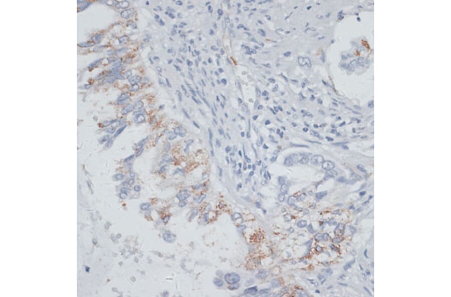 Immunohistochemistry - Anti-VIM Antibody (A2666) - Antibodies.com