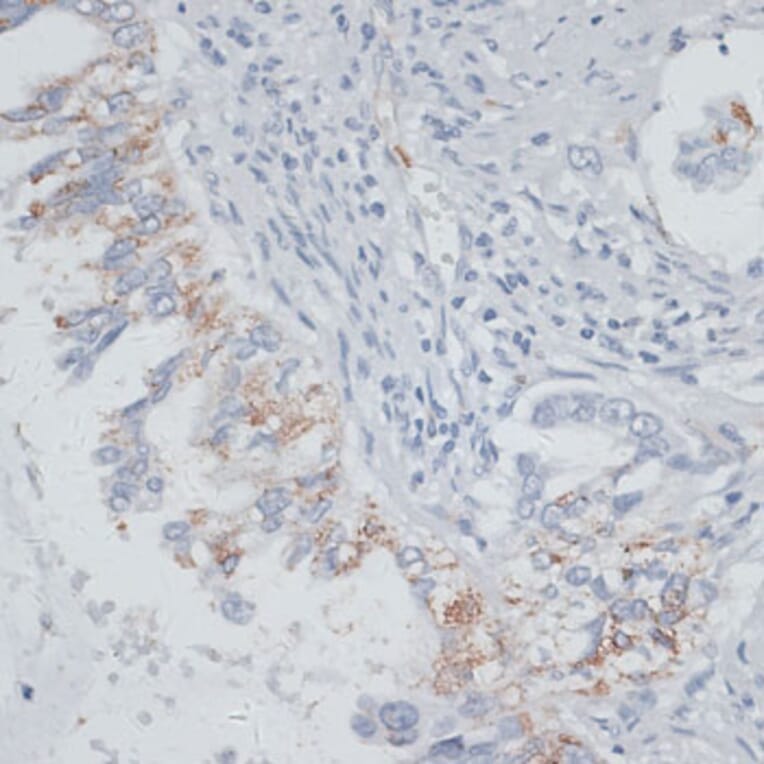 Immunohistochemistry - Anti-VIM Antibody (A2666) - Antibodies.com