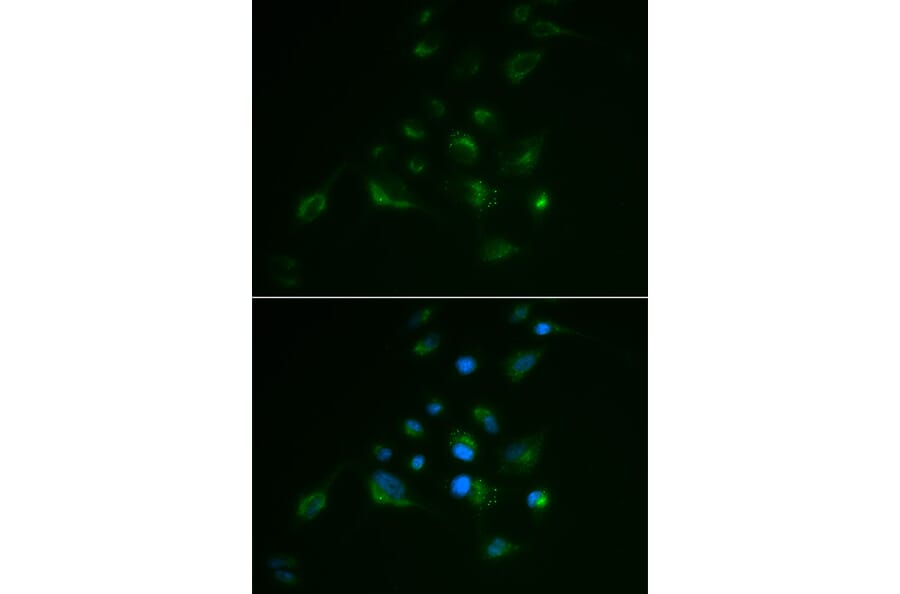 Immunofluorescence - Anti-VIM Antibody (A2666) - Antibodies.com