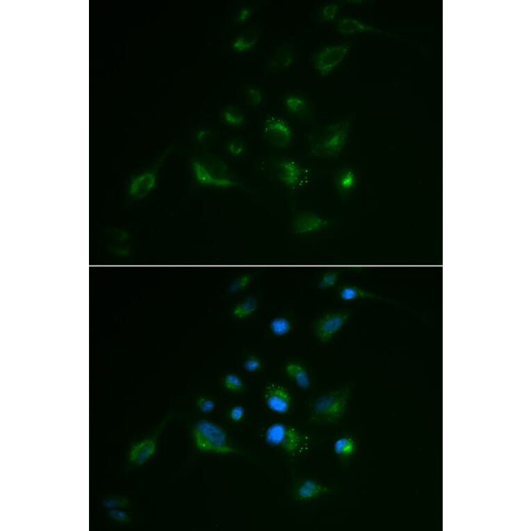 Immunofluorescence - Anti-VIM Antibody (A2666) - Antibodies.com