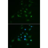 Immunofluorescence - Anti-VIM Antibody (A2666) - Antibodies.com