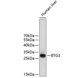 Western Blot - Anti-BTG3 Antibody (A14126) - Antibodies.com