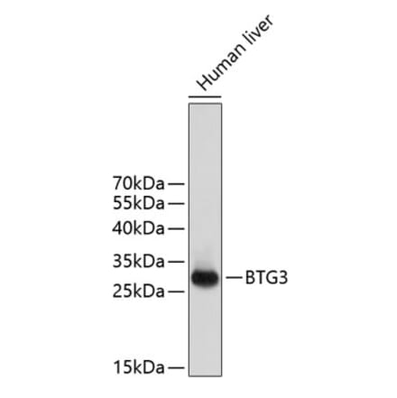 Western Blot - Anti-BTG3 Antibody (A14126) - Antibodies.com