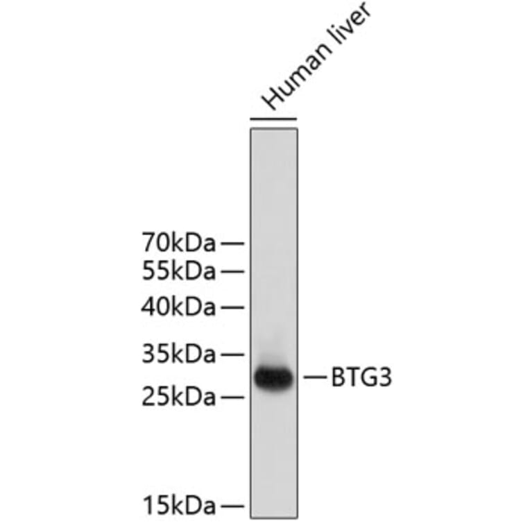 Western Blot - Anti-BTG3 Antibody (A14126) - Antibodies.com
