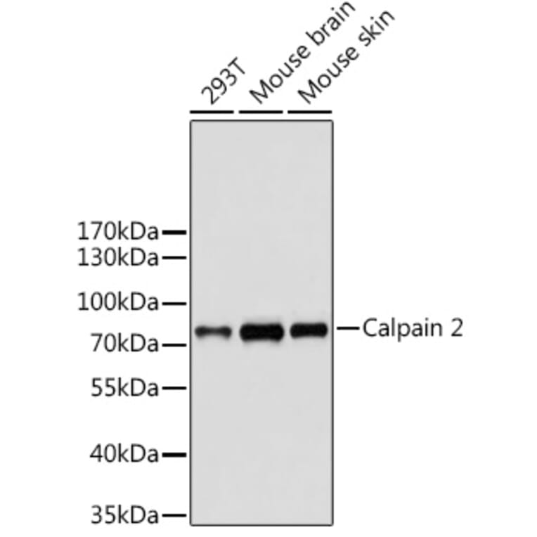 Western Blot - Anti-Calpain 2 Antibody (A14127) - Antibodies.com