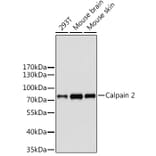 Western Blot - Anti-Calpain 2 Antibody (A14127) - Antibodies.com