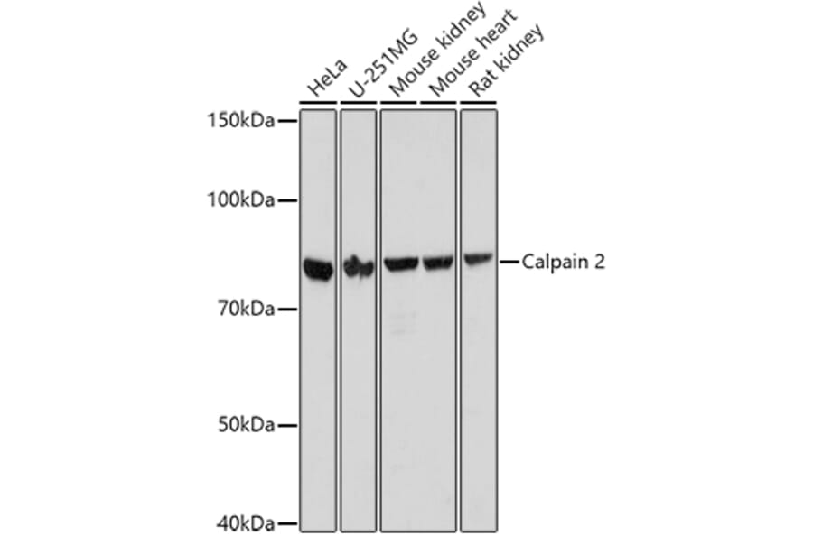Western Blot - Anti-Calpain 2 Antibody (A14127) - Antibodies.com