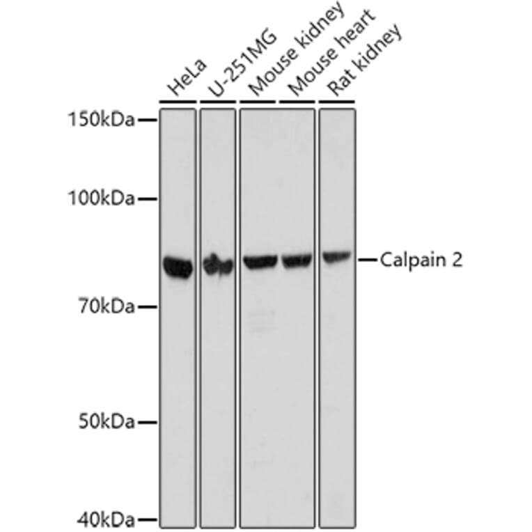 Western Blot - Anti-Calpain 2 Antibody (A14127) - Antibodies.com