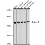 Western Blot - Anti-Calpain 2 Antibody (A14127) - Antibodies.com