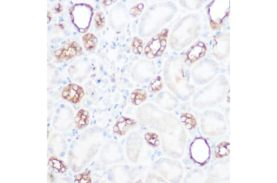 Immunohistochemistry - Anti-Calpain 2 Antibody (A14127) - Antibodies.com