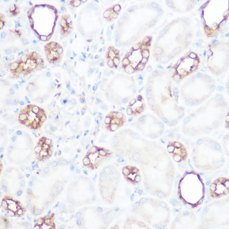 Immunohistochemistry - Anti-Calpain 2 Antibody (A14127) - Antibodies.com