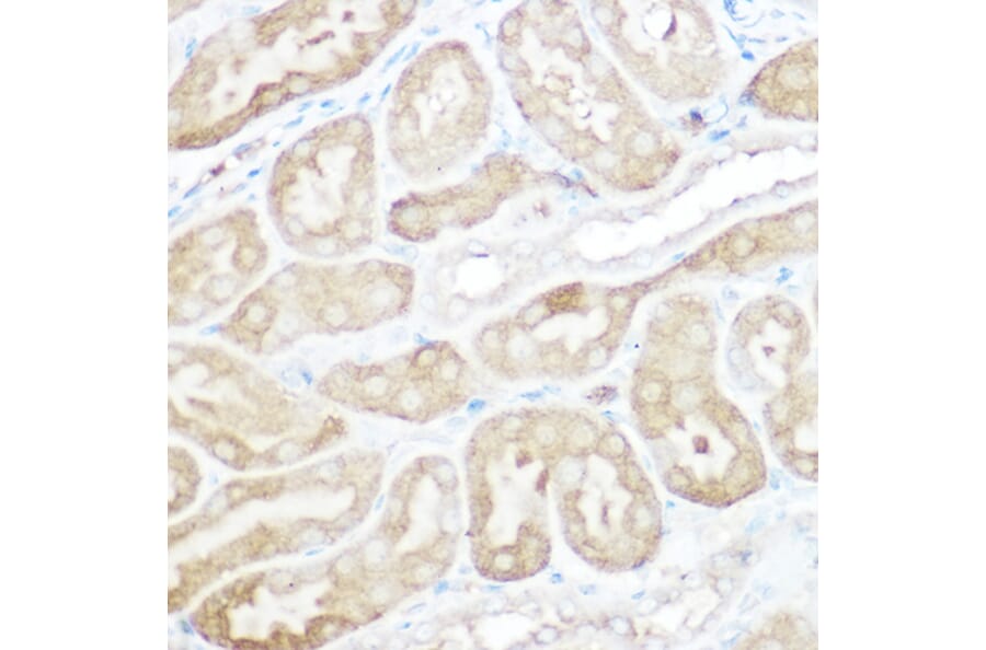 Immunohistochemistry - Anti-Calpain 2 Antibody (A14127) - Antibodies.com