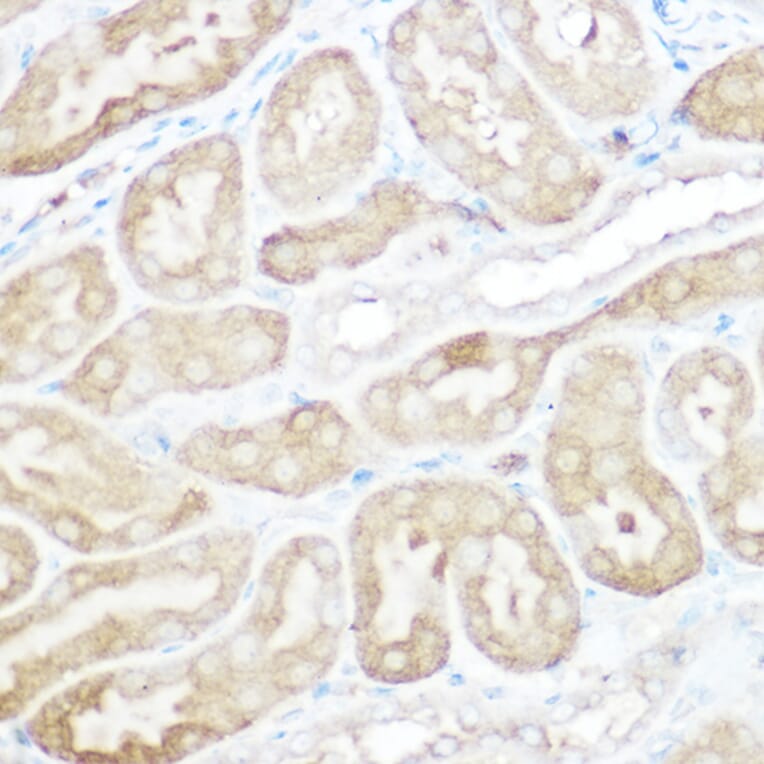 Immunohistochemistry - Anti-Calpain 2 Antibody (A14127) - Antibodies.com