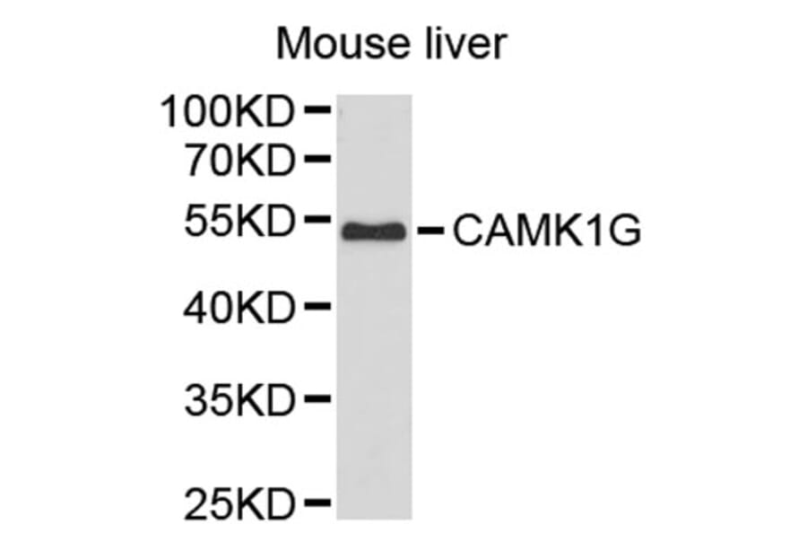 Western Blot - Anti-CAMK1G Antibody (A2674) - Antibodies.com