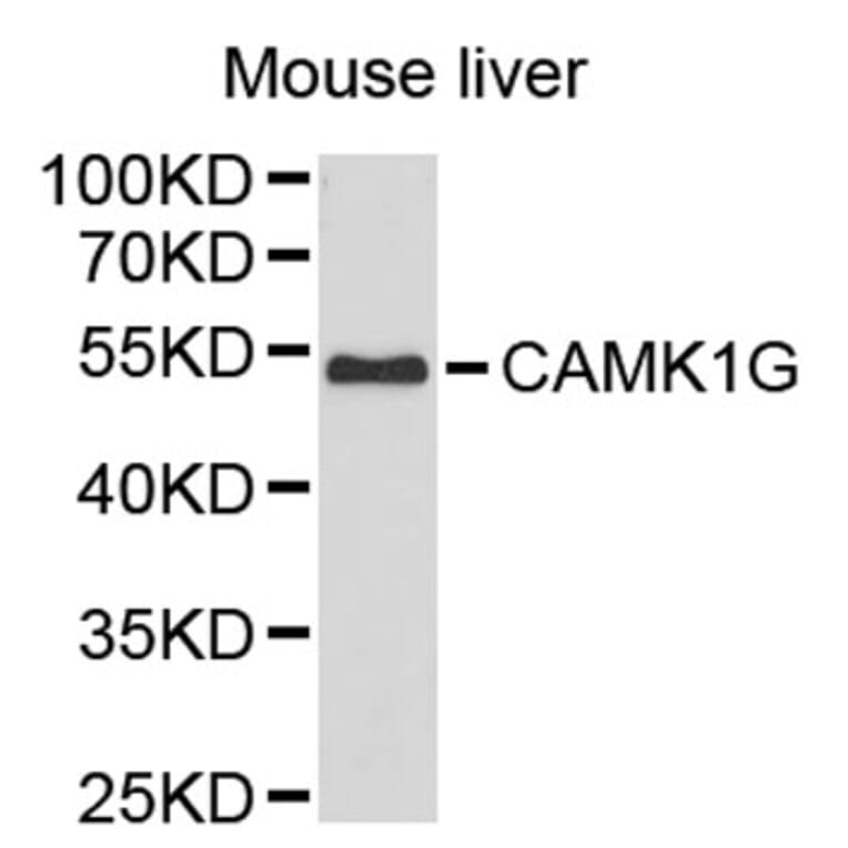 Western Blot - Anti-CAMK1G Antibody (A2674) - Antibodies.com
