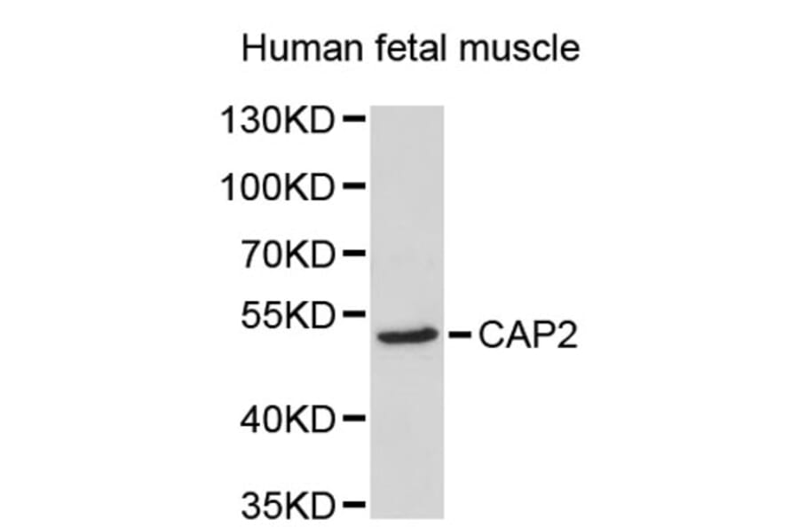 Western Blot - Anti-CAP2 Antibody (A2676) - Antibodies.com