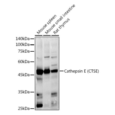 Western Blot - Anti-Cathepsin E Antibody (A14131) - Antibodies.com