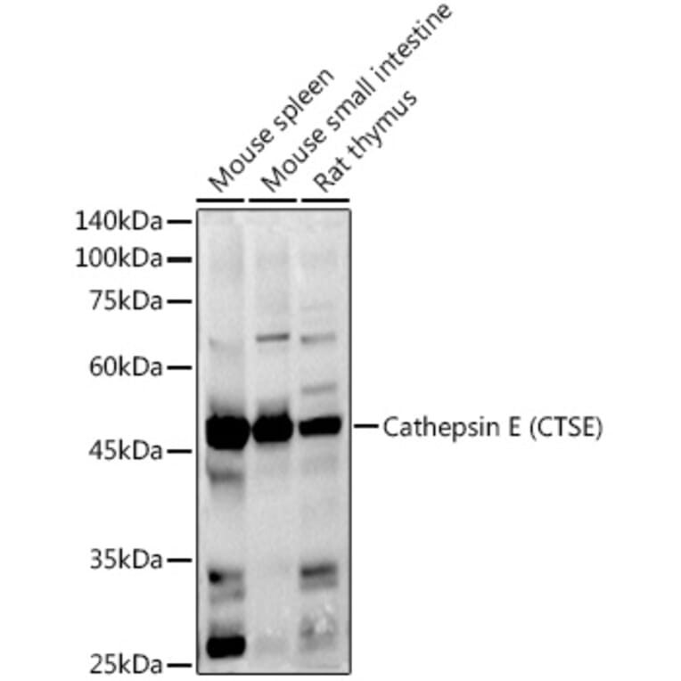 Western Blot - Anti-Cathepsin E Antibody (A14131) - Antibodies.com