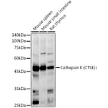 Western Blot - Anti-Cathepsin E Antibody (A14131) - Antibodies.com