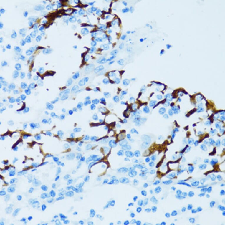 Immunohistochemistry - Anti-Cathepsin E Antibody (A14131) - Antibodies.com