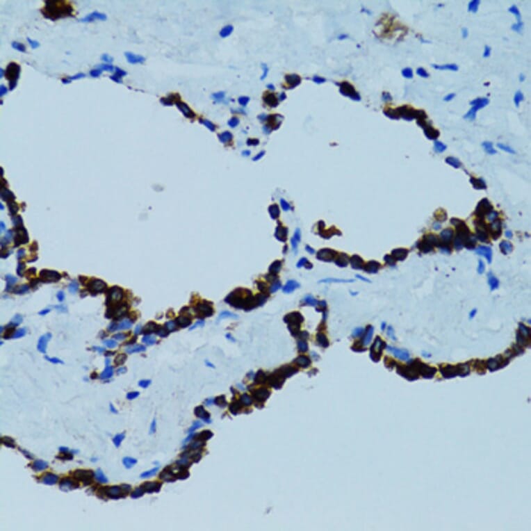 Immunohistochemistry - Anti-Cathepsin E Antibody (A14131) - Antibodies.com