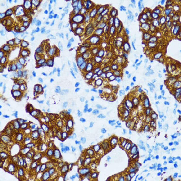 Immunohistochemistry - Anti-Cathepsin E Antibody (A14131) - Antibodies.com