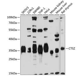 Western Blot - Anti-Cathepsin Z Antibody (A14132) - Antibodies.com
