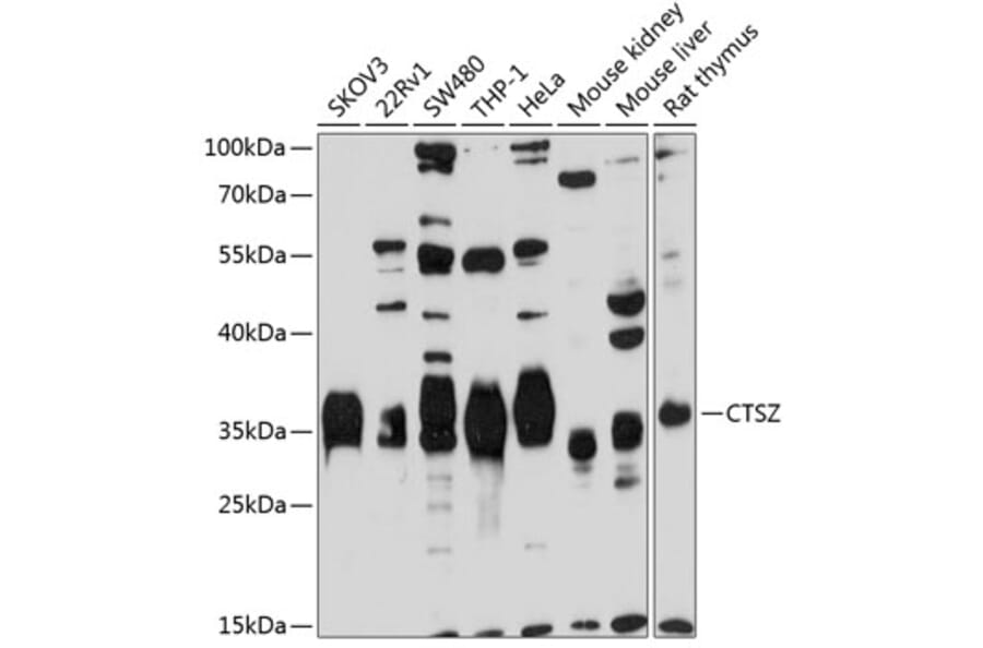 Western Blot - Anti-Cathepsin Z Antibody (A14132) - Antibodies.com